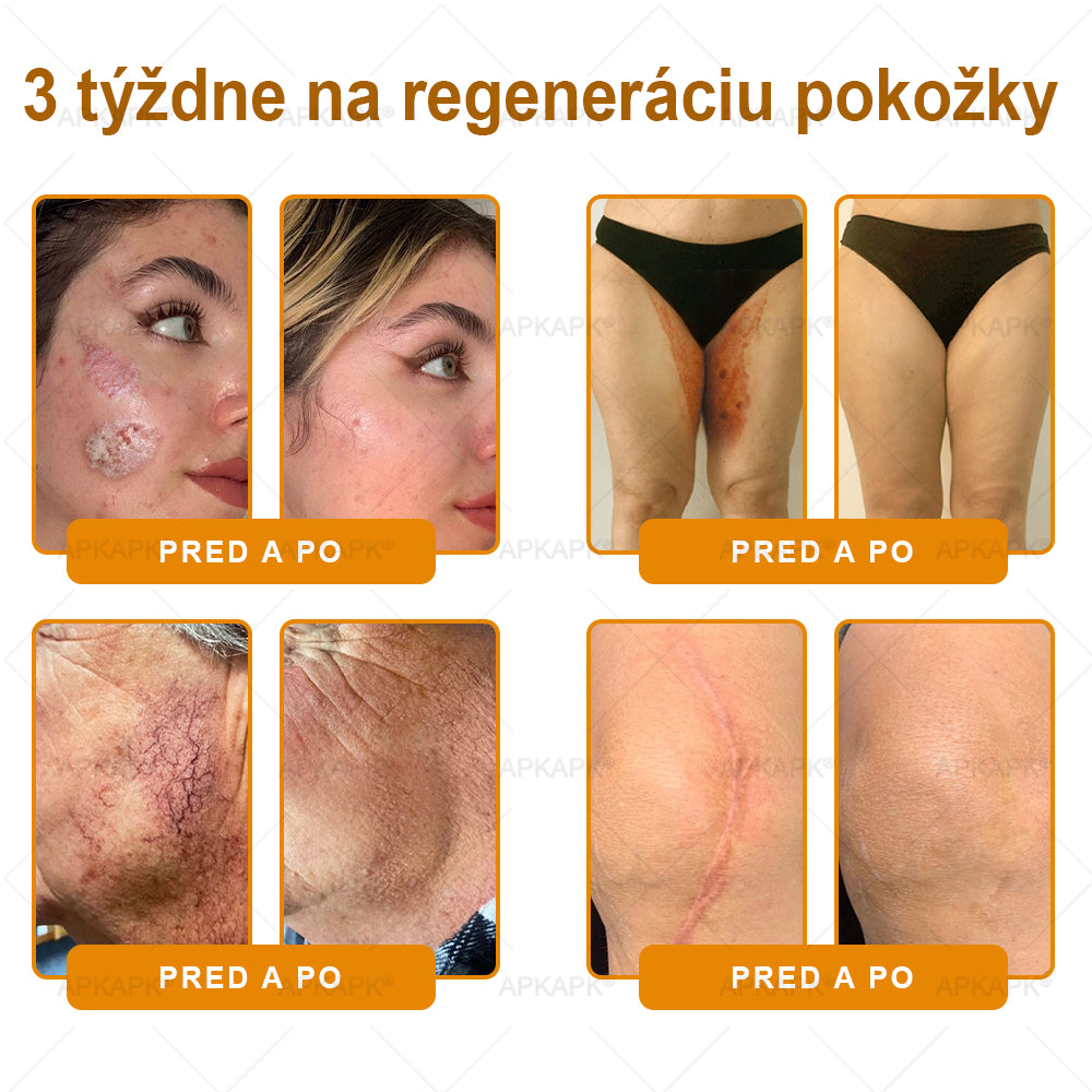 𝖠𝖯𝖪𝖠𝖯𝖪® 🐝🐝 Krém s včelím jedem na obnovu pokožky 🐝 pomáha pri riešení kožných problémov, ako sú: vrásky, jazvy, pigmentové škvrny, strie, akné, psoriáza, ekzém, kožné lézie, podráždenia, zápaly a ďalšie kožné problémy.