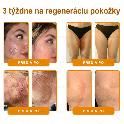 𝖠𝖯𝖪𝖠𝖯𝖪® 🐝🐝 Krém s včelím jedem na obnovu pokožky 🐝 pomáha pri riešení kožných problémov, ako sú: vrásky, jazvy, pigmentové škvrny, strie, akné, psoriáza, ekzém, kožné lézie, podráždenia, zápaly a ďalšie kožné problémy.