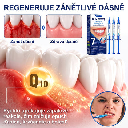 Prelomové klinické riešenie na regeneráciu ústnej dutiny 👨‍⚕️🦷 PureShade® GumRevive regeneračný gél na parodont🎁