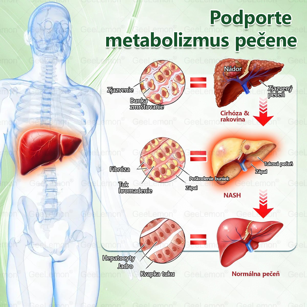 oficiálny obchod| 👩‍⚕️👩‍⚕️ 𝐆𝐞𝑒𝐿𝑒𝐦𝐨𝐧® Glumasetide 8 v 1 Nano mikrotŕňový náplasť – Len raz denne ✅ Viditeľné zmeny za 7 dní na obezitu, ochabnutú pokožku a zdravie