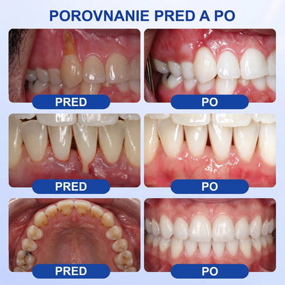 Prelomové klinické riešenie na regeneráciu ústnej dutiny 👨‍⚕️🦷 PureShade® GumRevive regeneračný gél na parodont🎁