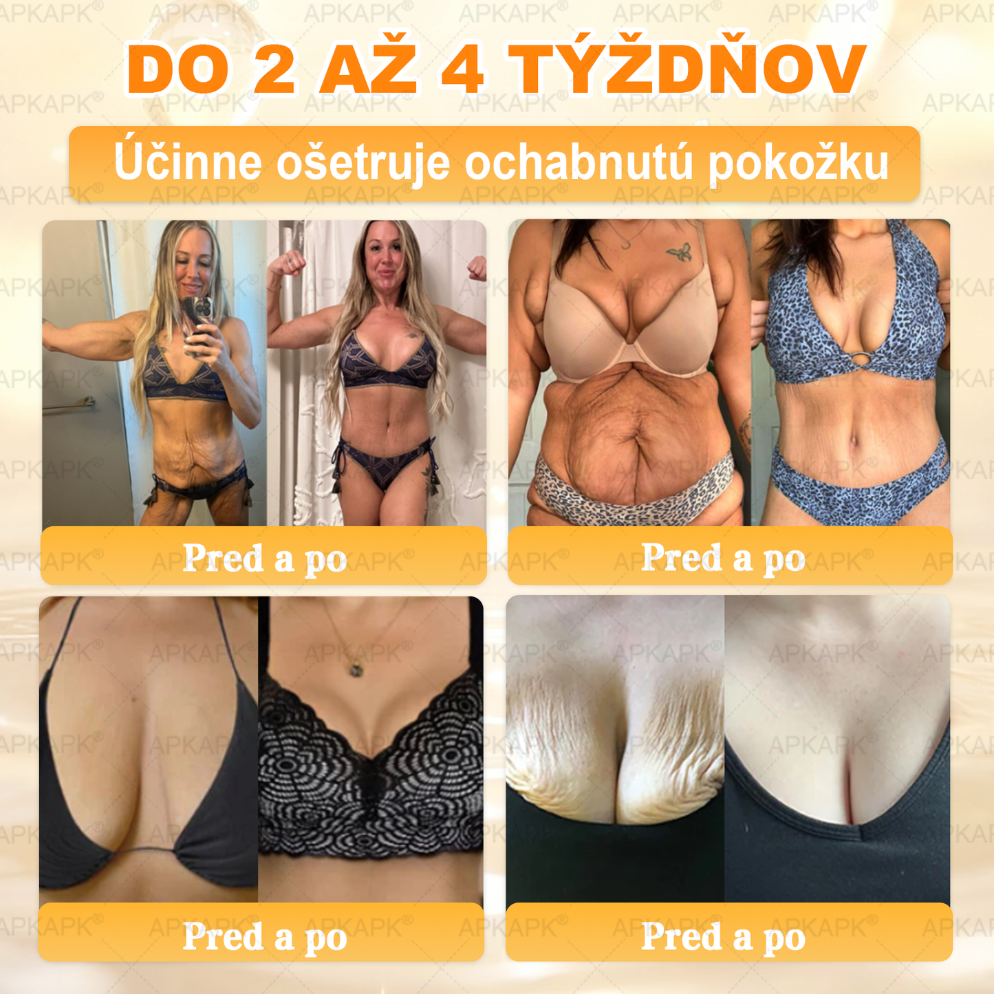 𝖠𝖯𝖪𝖠𝖯𝖪® 🐝🐝 Krém s včelím jedem na obnovu pokožky 🐝 pomáha pri riešení kožných problémov, ako sú: vrásky, jazvy, pigmentové škvrny, strie, akné, psoriáza, ekzém, kožné lézie, podráždenia, zápaly a ďalšie kožné problémy.