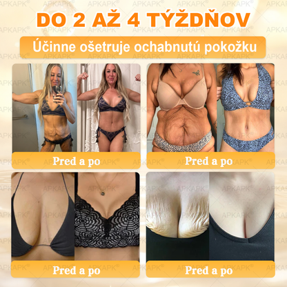 𝖠𝖯𝖪𝖠𝖯𝖪® 🐝🐝 Krém s včelím jedem na obnovu pokožky 🐝 pomáha pri riešení kožných problémov, ako sú: vrásky, jazvy, pigmentové škvrny, strie, akné, psoriáza, ekzém, kožné lézie, podráždenia, zápaly a ďalšie kožné problémy.