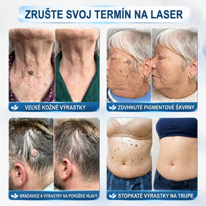 𝑶𝒇𝒊𝒄𝒊á𝒍𝒏𝒚 𝒐𝒃𝒄𝒉𝒐𝒅 ✅️👨‍⚕️| 𝐇𝐈𝐒𝐊𝐈𝐍® 7-𝒅ň𝒐𝒗ý 𝒑𝒓í𝒑𝒓𝒂𝒗𝒐𝒌 𝒏𝒂 𝒐𝒅𝒔𝒕𝒓á𝒏𝒆𝒏𝒊𝒆 𝒌𝒐ž𝒏ý𝒄𝒉 𝒗ý𝒓𝒂𝒔𝒕𝒌𝒐𝒗 𝒂 𝒑𝒊𝒈𝒎𝒆𝒏𝒕𝒐𝒗ý𝒄𝒉 š𝒌𝒗ŕ𝒏👩‍⚕️ (𝒃𝒆𝒛 𝒃𝒐𝒍𝒆𝒔𝒕𝒊, 𝒃𝒆𝒛 𝒋𝒂𝒛𝒊𝒆𝒗, 𝒑𝒓𝒆𝒔𝒏ý 𝒓𝒐𝒍𝒍-𝒐𝒏 𝒂𝒑𝒍𝒊𝒌á𝒕𝒐𝒓) 🔥
