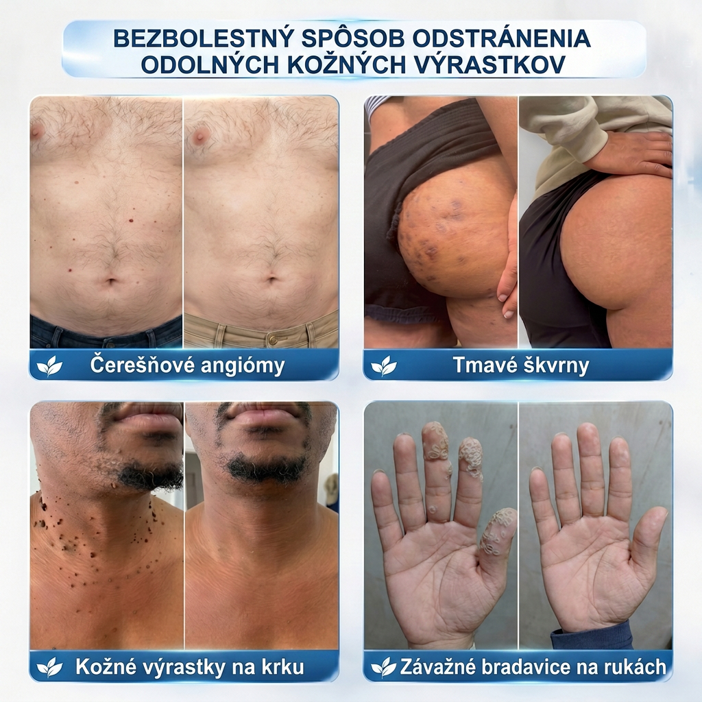 𝑶𝒇𝒊𝒄𝒊á𝒍𝒏𝒚 𝒐𝒃𝒄𝒉𝒐𝒅 ✅️👨‍⚕️| 𝐇𝐈𝐒𝐊𝐈𝐍® 7-𝒅ň𝒐𝒗ý 𝒑𝒓í𝒑𝒓𝒂𝒗𝒐𝒌 𝒏𝒂 𝒐𝒅𝒔𝒕𝒓á𝒏𝒆𝒏𝒊𝒆 𝒌𝒐ž𝒏ý𝒄𝒉 𝒗ý𝒓𝒂𝒔𝒕𝒌𝒐𝒗 𝒂 𝒑𝒊𝒈𝒎𝒆𝒏𝒕𝒐𝒗ý𝒄𝒉 š𝒌𝒗ŕ𝒏👩‍⚕️ (𝒃𝒆𝒛 𝒃𝒐𝒍𝒆𝒔𝒕𝒊, 𝒃𝒆𝒛 𝒋𝒂𝒛𝒊𝒆𝒗, 𝒑𝒓𝒆𝒔𝒏ý 𝒓𝒐𝒍𝒍-𝒐𝒏 𝒂𝒑𝒍𝒊𝒌á𝒕𝒐𝒓) 🔥
