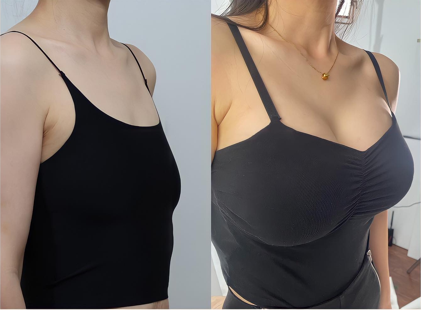 📦HISKIN® Náplasti s mikroihličkami na zväčšenie objemu, spevnenie a lifting poprsia