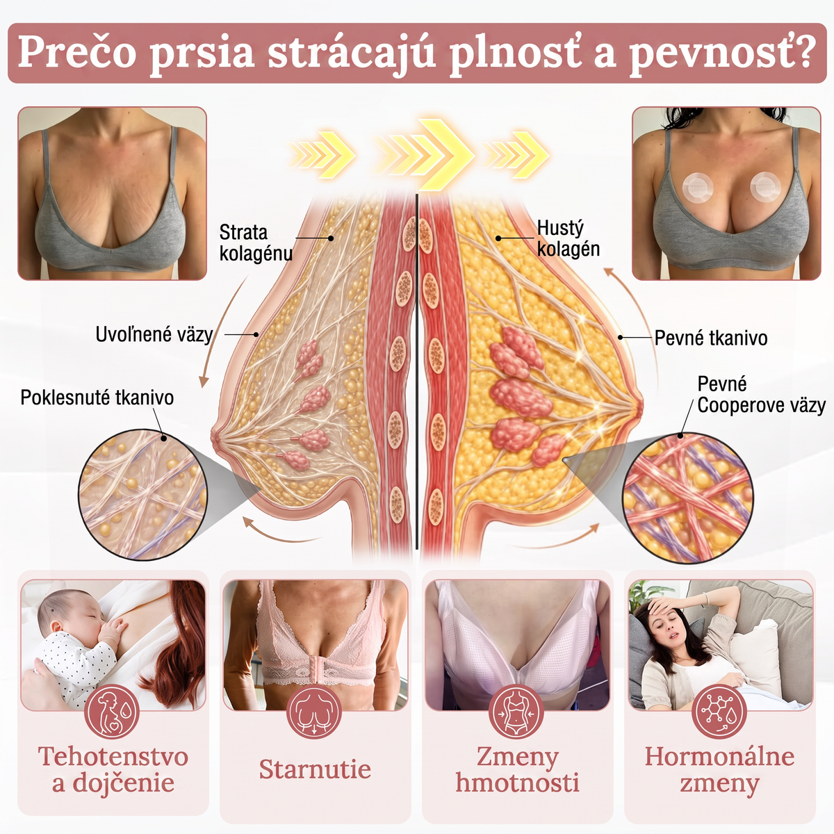 📦HISKIN® Náplasti s mikroihličkami na zväčšenie objemu, spevnenie a lifting poprsia