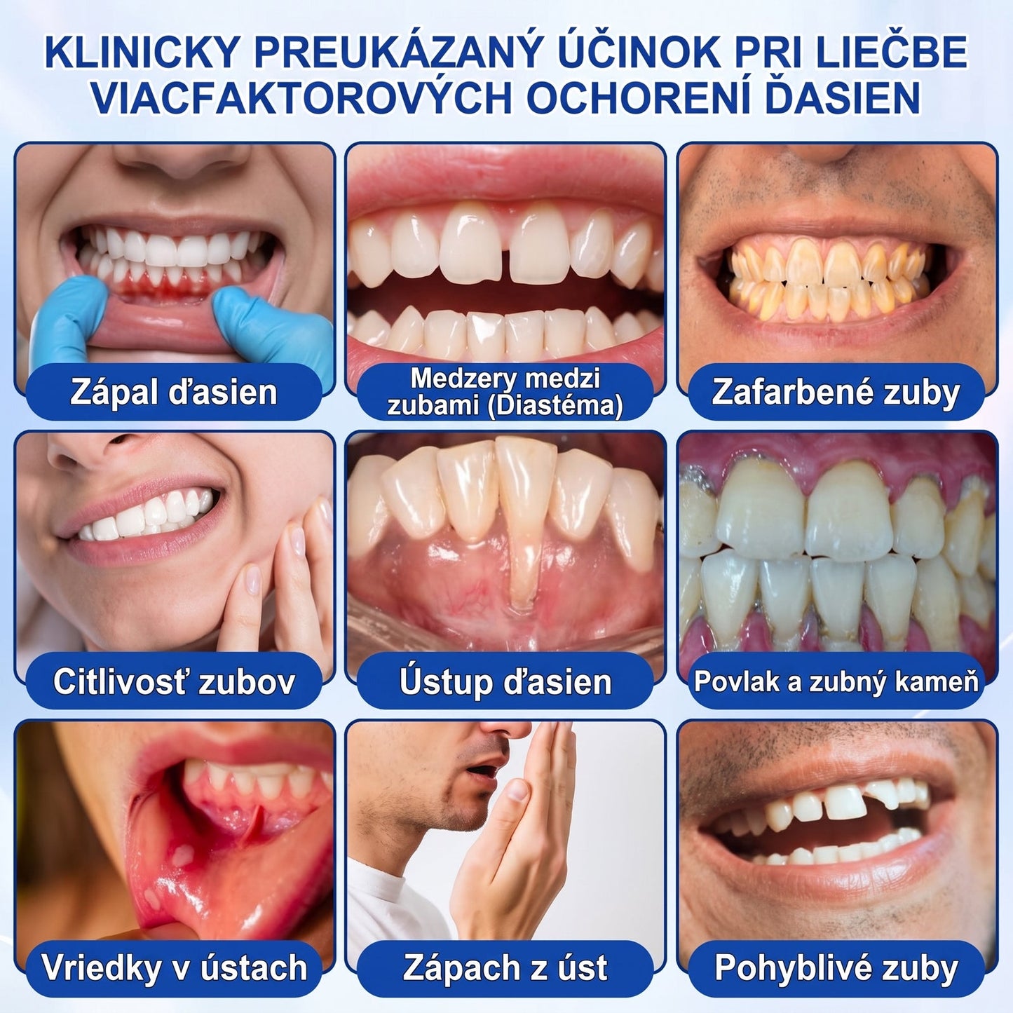 Prelomové klinické riešenie na regeneráciu ústnej dutiny 👨‍⚕️🦷 PureShade® GumRevive regeneračný gél na parodont🎁