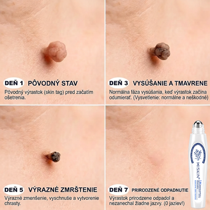𝑶𝒇𝒊𝒄𝒊á𝒍𝒏𝒚 𝒐𝒃𝒄𝒉𝒐𝒅 ✅️👨‍⚕️| 𝐇𝐈𝐒𝐊𝐈𝐍® 7-𝒅ň𝒐𝒗ý 𝒑𝒓í𝒑𝒓𝒂𝒗𝒐𝒌 𝒏𝒂 𝒐𝒅𝒔𝒕𝒓á𝒏𝒆𝒏𝒊𝒆 𝒌𝒐ž𝒏ý𝒄𝒉 𝒗ý𝒓𝒂𝒔𝒕𝒌𝒐𝒗 𝒂 𝒑𝒊𝒈𝒎𝒆𝒏𝒕𝒐𝒗ý𝒄𝒉 š𝒌𝒗ŕ𝒏👩‍⚕️ (𝒃𝒆𝒛 𝒃𝒐𝒍𝒆𝒔𝒕𝒊, 𝒃𝒆𝒛 𝒋𝒂𝒛𝒊𝒆𝒗, 𝒑𝒓𝒆𝒔𝒏ý 𝒓𝒐𝒍𝒍-𝒐𝒏 𝒂𝒑𝒍𝒊𝒌á𝒕𝒐𝒓) 🔥