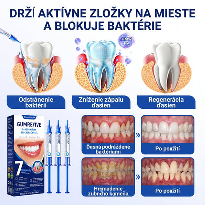 Prelomové klinické riešenie na regeneráciu ústnej dutiny 👨‍⚕️🦷 PureShade® GumRevive regeneračný gél na parodont🎁