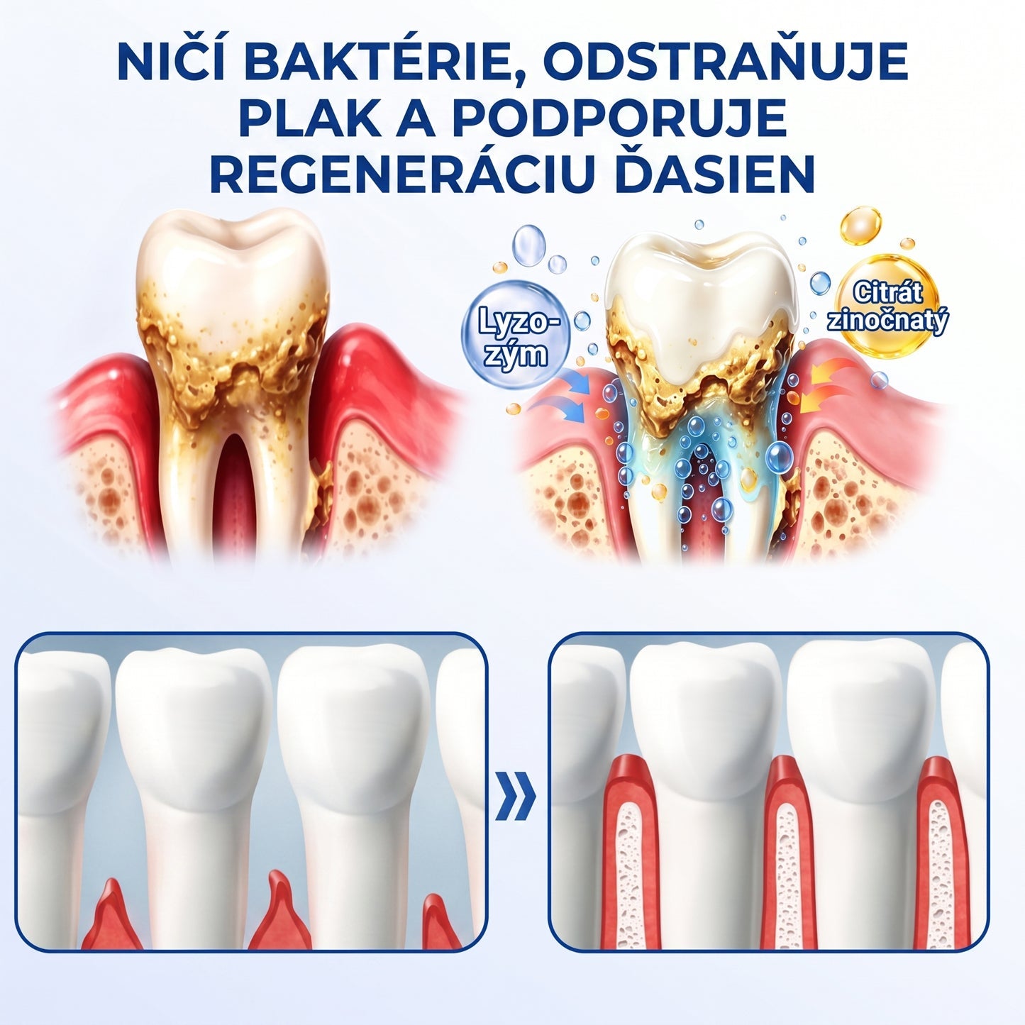 Prelomové klinické riešenie na regeneráciu ústnej dutiny 👨‍⚕️🦷 PureShade® GumRevive regeneračný gél na parodont🎁