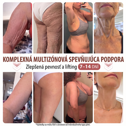 📦HISKIN® Náplasti s mikroihličkami na zväčšenie objemu, spevnenie a lifting poprsia