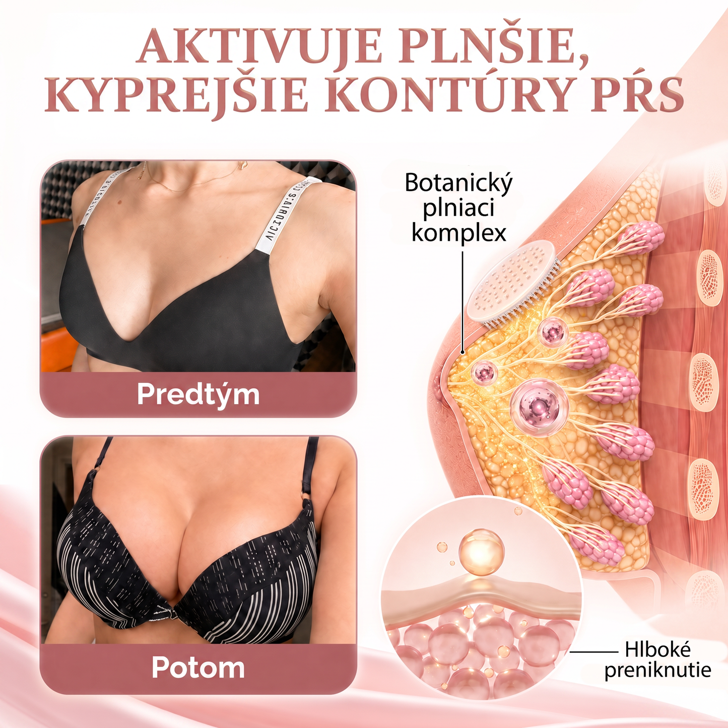 📦HISKIN® Náplasti s mikroihličkami na zväčšenie objemu, spevnenie a lifting poprsia